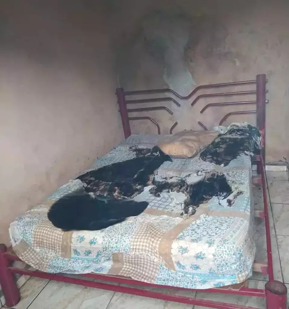 Adolescente queimado enquanto dormia morre sete meses após o ataque Adolescente queimado enquanto dormia em Nova Alvorada do Sul morre sete meses após o ataque