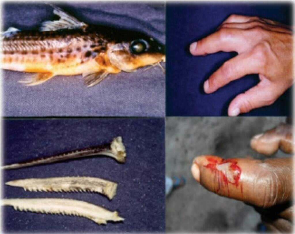 Pouco conhecidos, peixes peçonhentos podem ajudar na descoberta de medicamentos Pouco conhecidos, peixes peçonhentos podem ajudar na descoberta de medicamentos