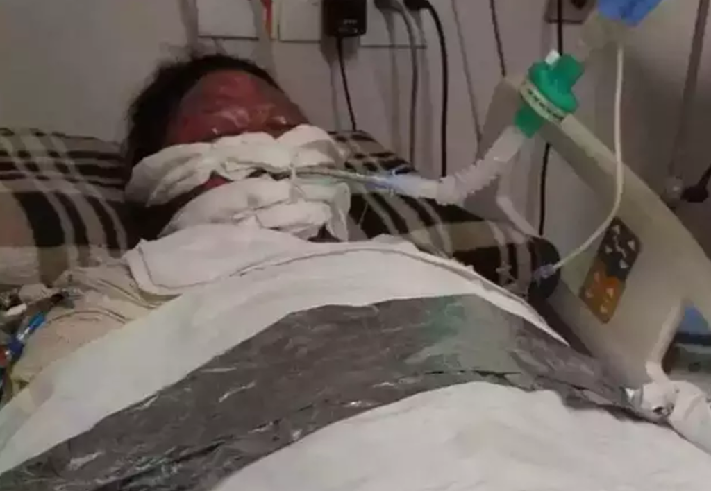 Justiça manda INSS pagar pensão a filhos de mulher queimada pelo marido Justiça manda INSS pagar pensão a filhos de mulher queimada pelo marido