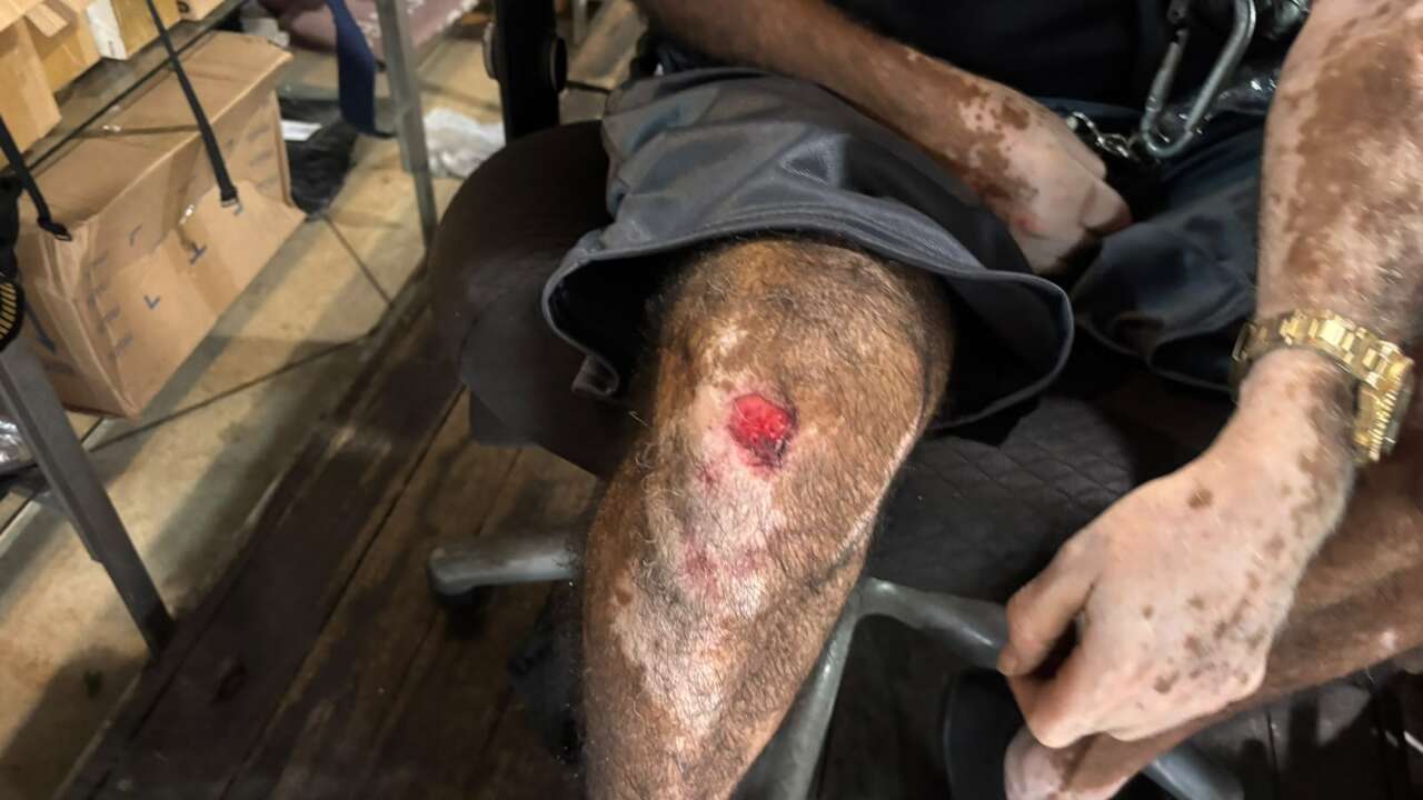 “Me livrei da morte 2 vezes”, diz comerciante ferido em tentativa de roubo