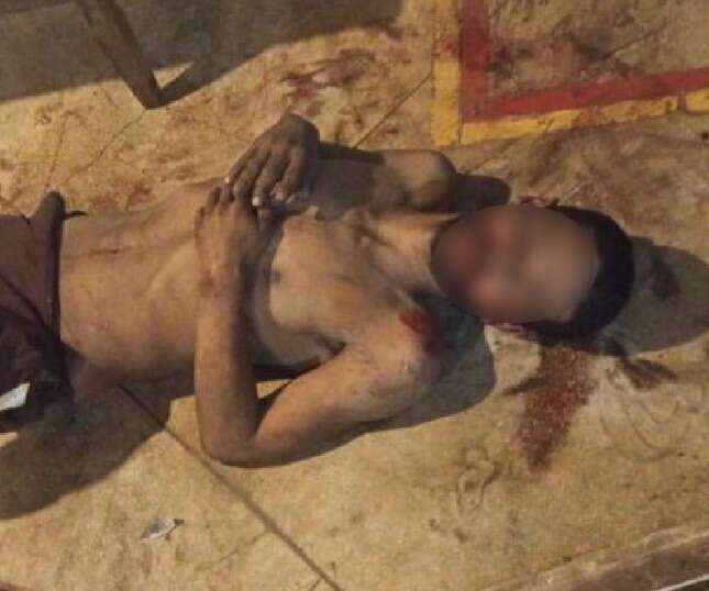 “Me livrei da morte 2 vezes”, diz comerciante ferido em tentativa de roubo